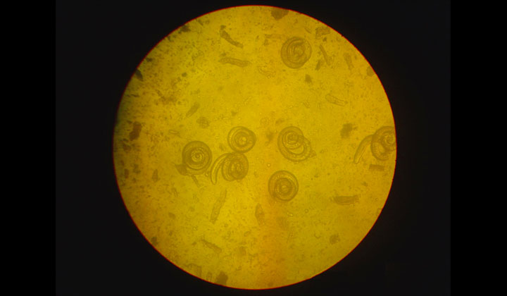 Trichinella al microscopio
